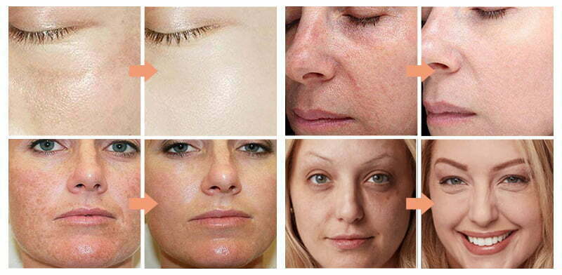 Benefits of using face cream
